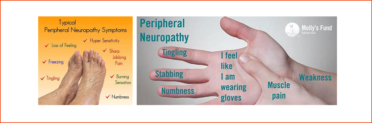 diabetic neuropathy symptoms hands