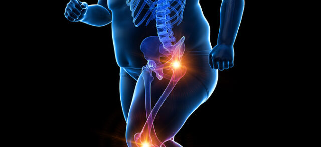 Weight and Joint Pain