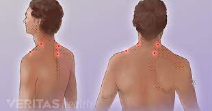 Trigger Point Exercises for Neck Pain